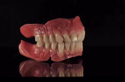 Full Denture