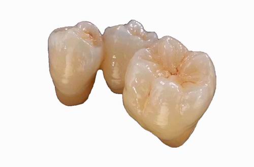 Full  Zirconia Crown