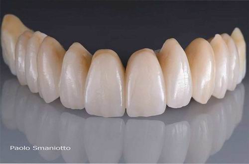 Zirconia  Crown / Bridge   